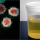 On left, COVID-19 virus; on right, urine sample in plastic specimen cup